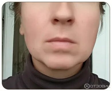 Щеки внизу