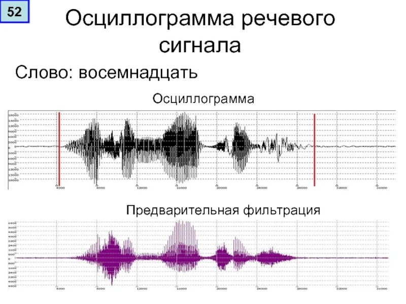 Осциллограмма речевого сигнала. Осциллограмма сигнала изображения 720p. Осциллограмма звукового сигнала. Осциллограмма цветоразностного сигнала.