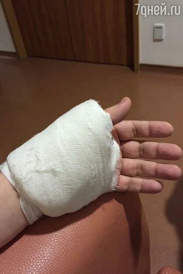 Руки обматывались мягкими эластичными ремешками