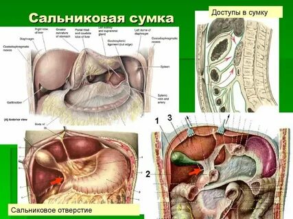 Сдать полость