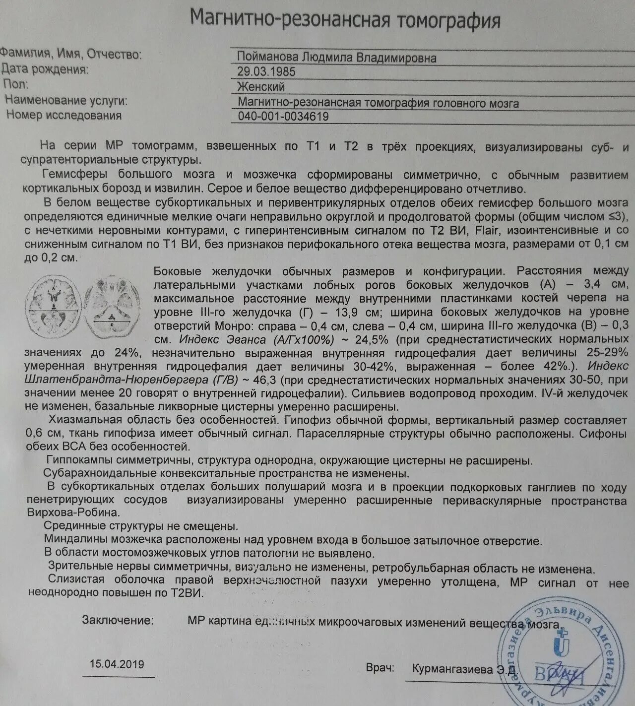 Повышенный сигнал т2 ви