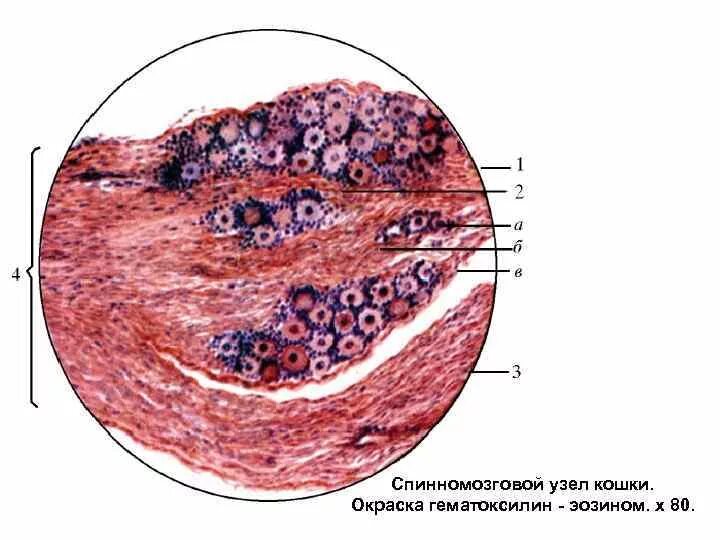 Клетки спинномозгового узла. Спинальный ганглий гистология. Спинальный ганглий. Окраска гематоксилином и эозином.. Спинномозговой ганглий гистология. Спинномозговой узел гистология препарат.