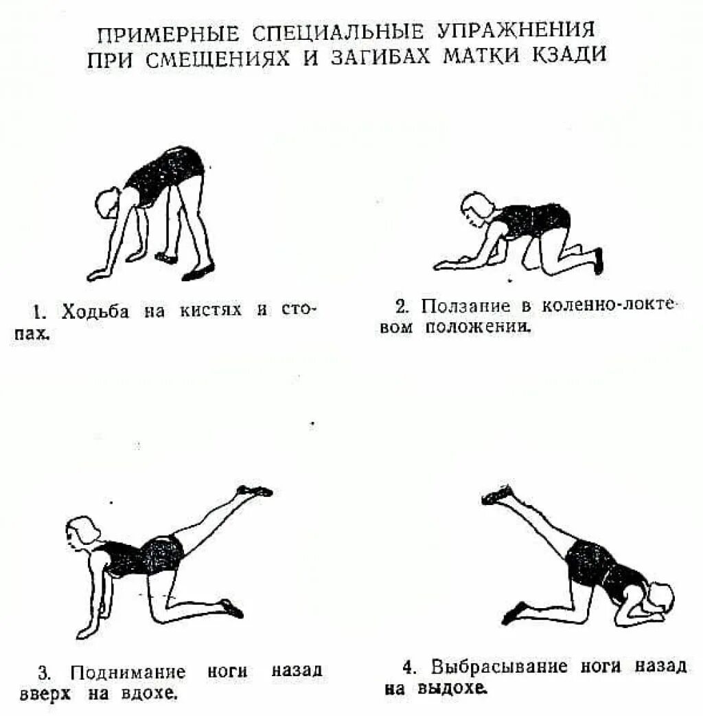 Упражнения для либидо. Загиб матки кзади и беременность. Упражнения при беременности загибе матки кзади. Комплекс упражнений при загибе матки кзади. Комплекс упражнений при ретрофлексии матки.