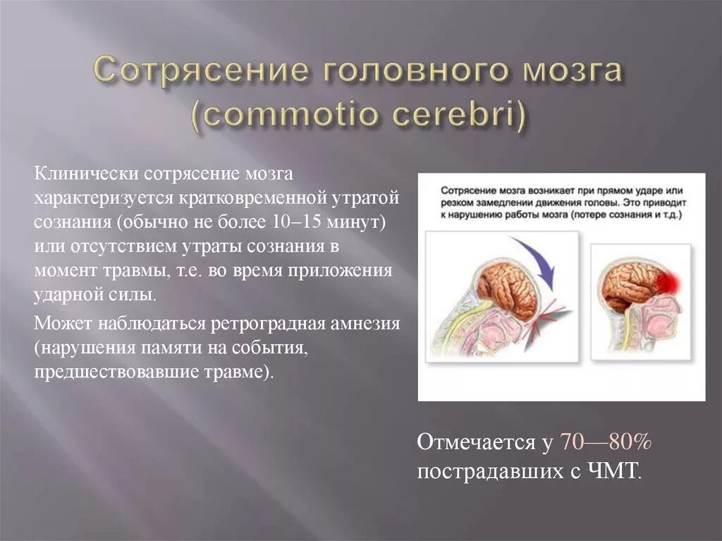 Сотрясение лечение у взрослых. Признаки повреждения мозга. Признаки повреждения могза.