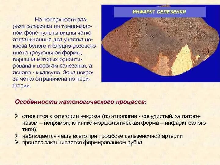 Плотный обнаружить