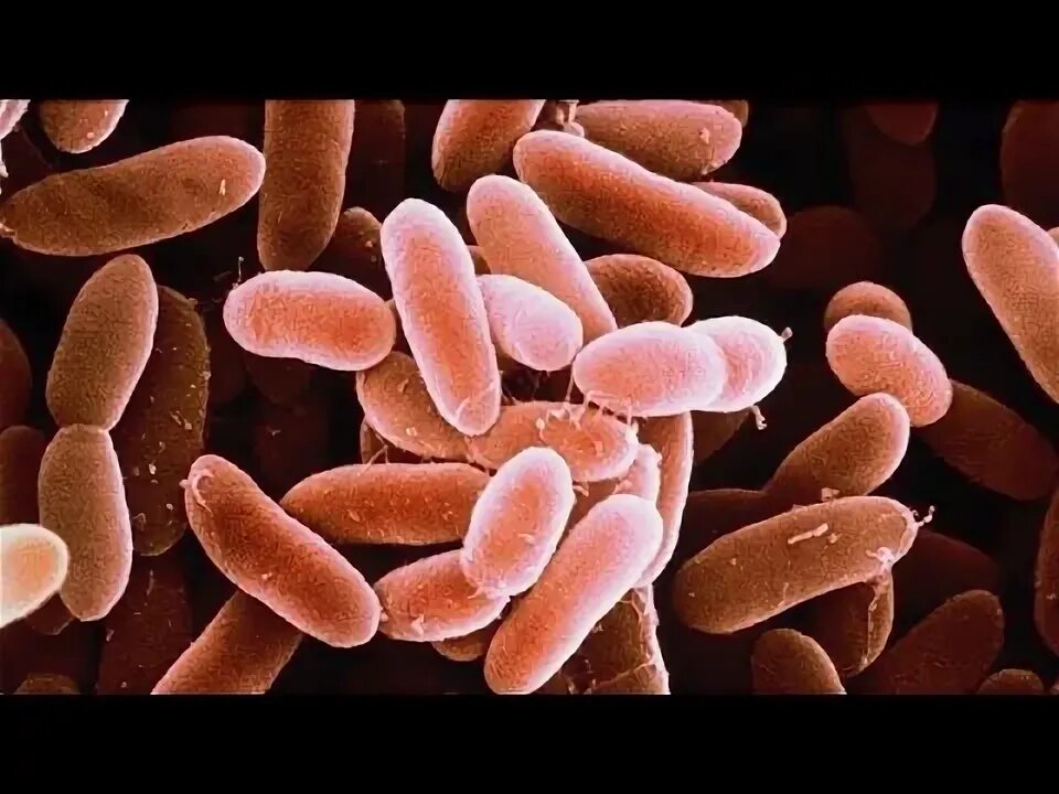 More than 400 food items in nine states recalled over potential listeria contami
