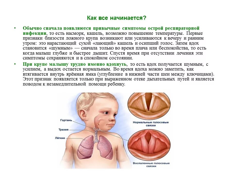 Новорожденный тяжело дышит. Круп кашель симптомы у детей. Кашель ложный круп у ребенка. Ложный круп у детей первая помощь.