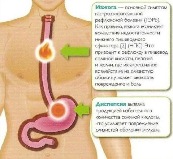 Боли в горле и пищеводе