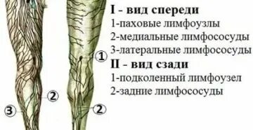 Почему болит лимфоузел в паху