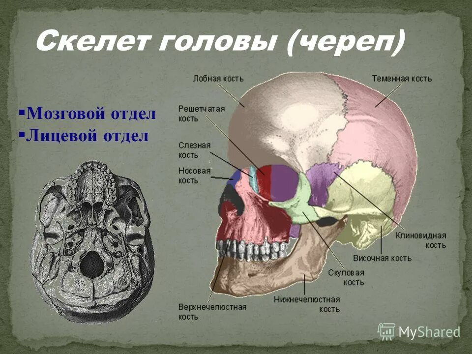 Кости черепа теменная кость анатомия. Решетчатая кость головы. Кости мозгового черепа лобная кость. Строение костей черепной коробки. В правом черепе