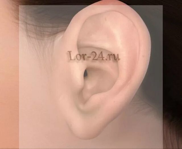 Отопластика (1 ушная раковина). Строение наружного уха хрящ. Строение наружного уха анатомия. Строение наружного уха хрящ. Хрящ ушной раковины.