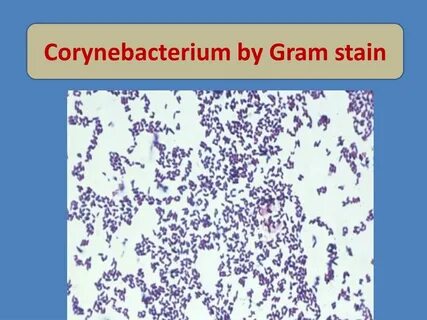 Corynebacterium