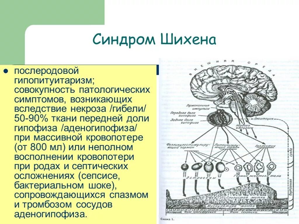 Послеродовой гипопитуитаризм (синдром Симмондса – Шихена). Синдром Шихана патогенез. Синдром Шихана (послеродовый пангипопитуитаризм).. Синдром Шихана этиология.