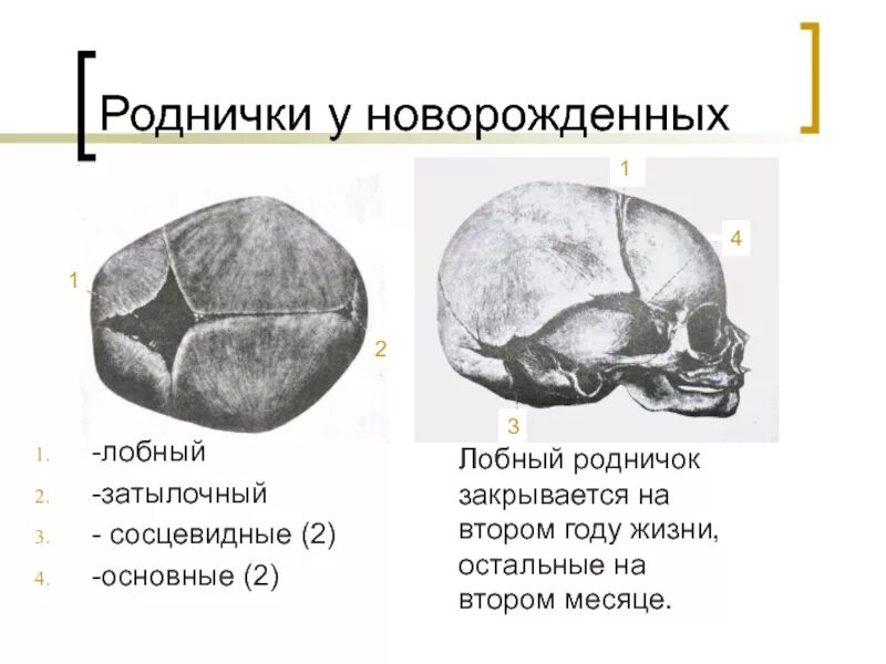 Размер родничка. Передний Родничок черепа новорожденного. Роднички черепа анатомия. Кости черепа роднички. Сосцевидный Родничок черепа.
