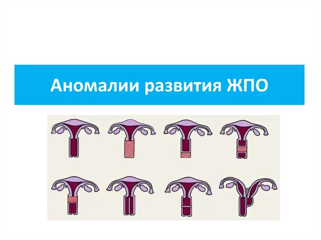 Аномалии развития половых органов. Аномалии развития женских органов. Пороки развития женских половых органов. Классификация аномалий развития женских органов.