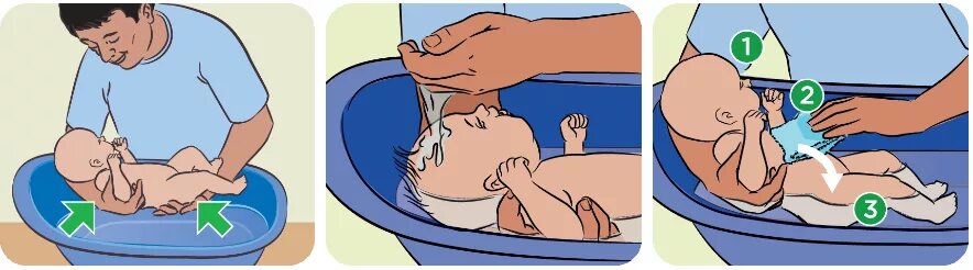 Купание новорожденного ребенка алгоритм. Алгоритм купания малыша в ванночке. Купание грудного ребенка алгоритм. Как держать новорожденного при купании.
