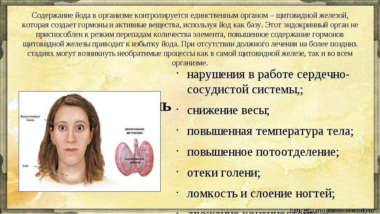 Щитовидная железа йод фтор. Избыток йода в организме. Избыток йода в организме симптомы. Дефицит йода. Симптомы при избытке йода.