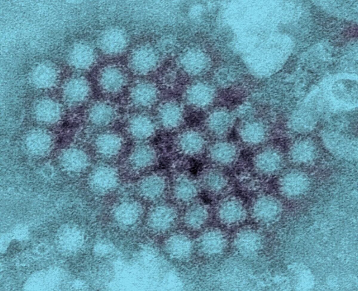 Enterovirus d68. На предоставленной фотографии заметны вирионы. Вирус reoviridae. Вирионы. На предоставленной фотографии заметны вирионы.