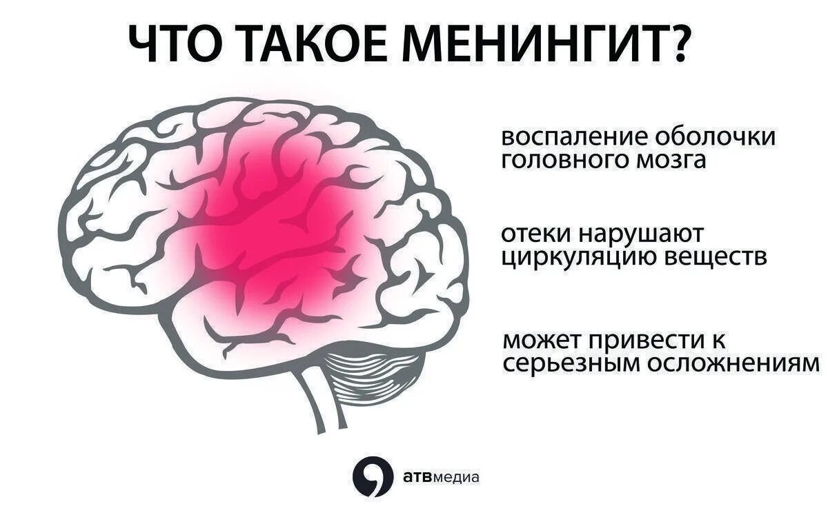 Вирусное заболевание головы