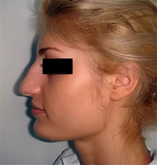 кулиев теймур арифович пластический хирург