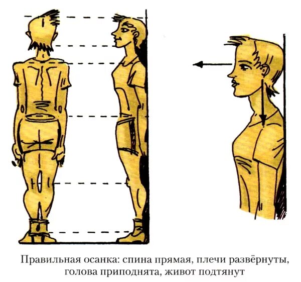 Нарушения осанки возникают. Нарушения осанки возникают