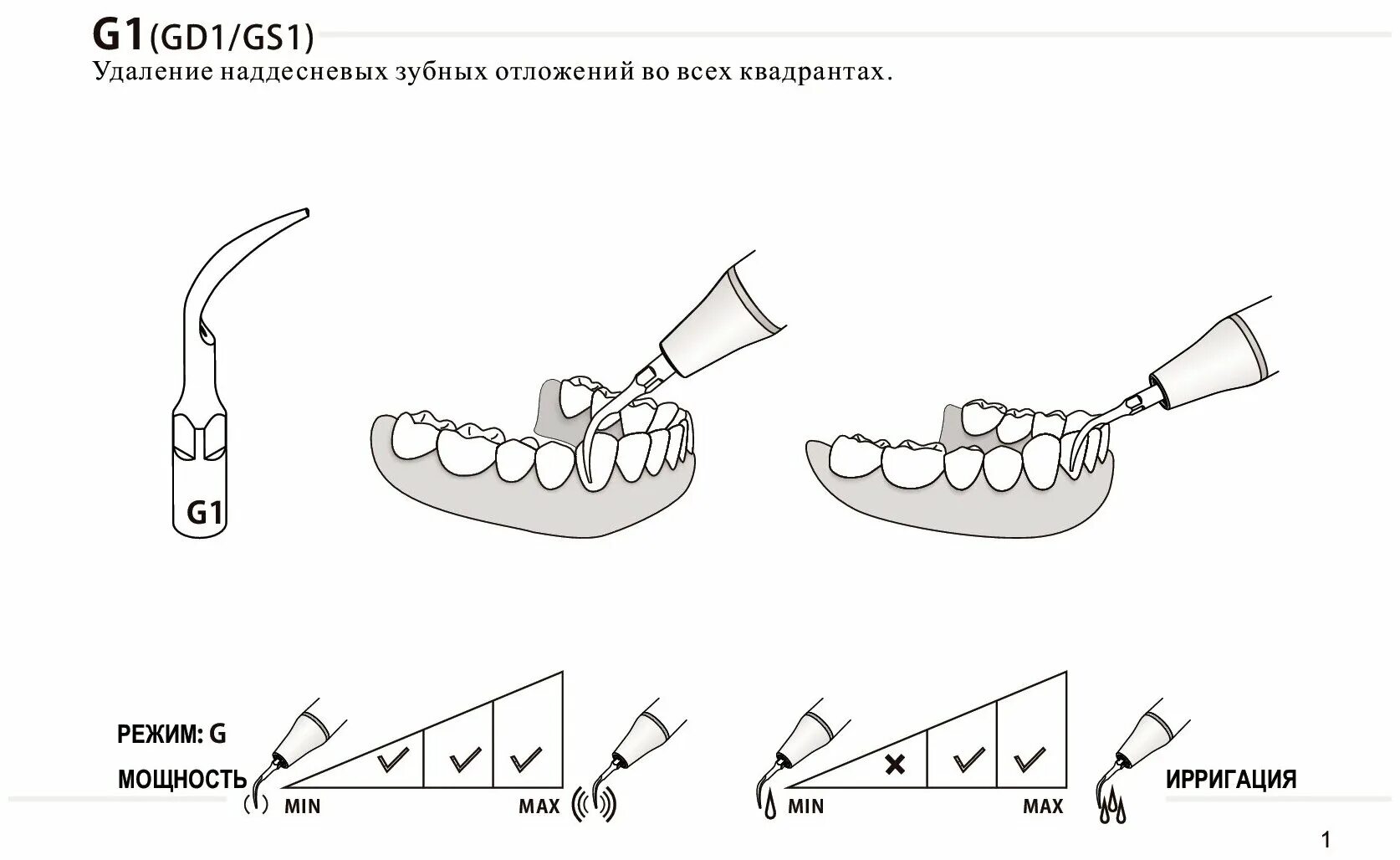 Как пользоваться зубным скалером. Ультразвуковой электрический стоматологический скалер. Очиститель зубов sonic pic dental cleaning system. Ультразвуковой скейлер сохо наконечник. Электрический ультразвуковой зубной скалер.