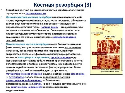 Резорбция костной ткани это