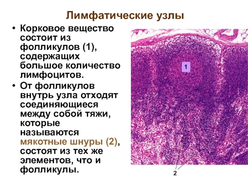 Лимфатический узел гистология препарат. Лимфатич узел гистология. Зоны лимфатического узла гистология. Корковое вещество лимфатического узла гистология. 17 фолликулам