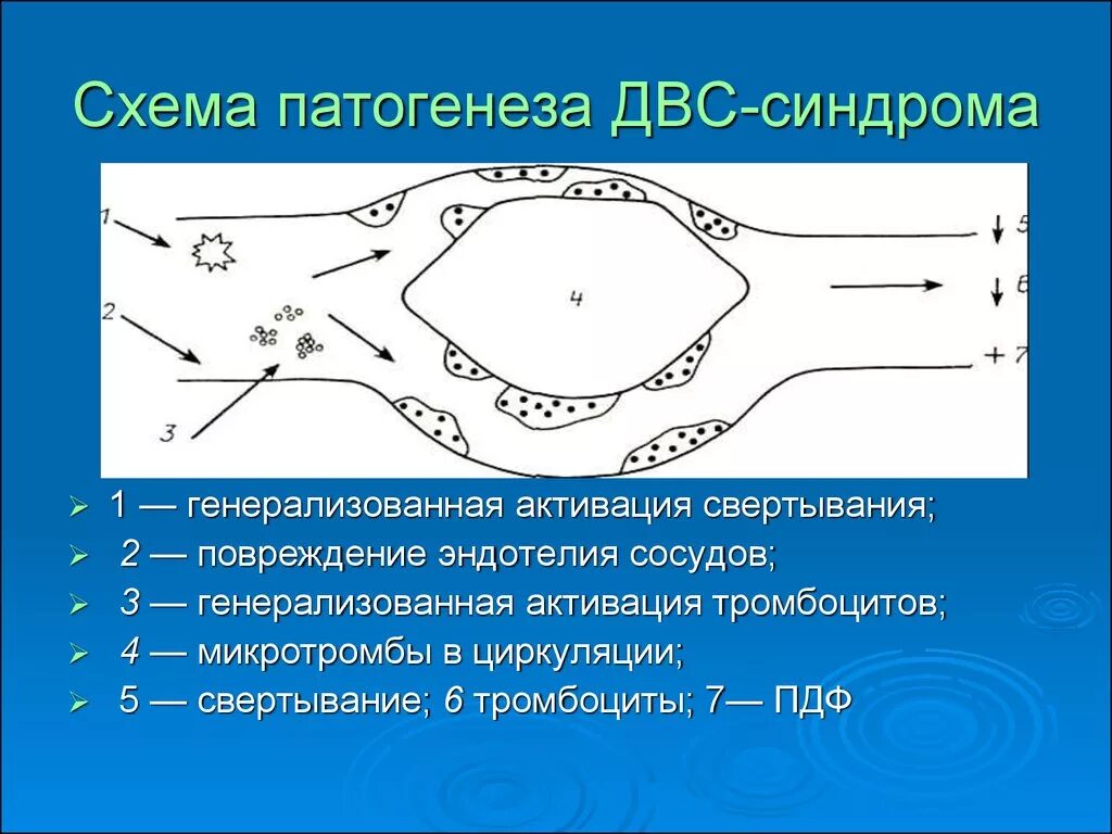 Двс синдром является. Патогенез двс синдрома схема. двс синдром механизм развития. синдром диссеминированного внутрисосудистого свертывания.
