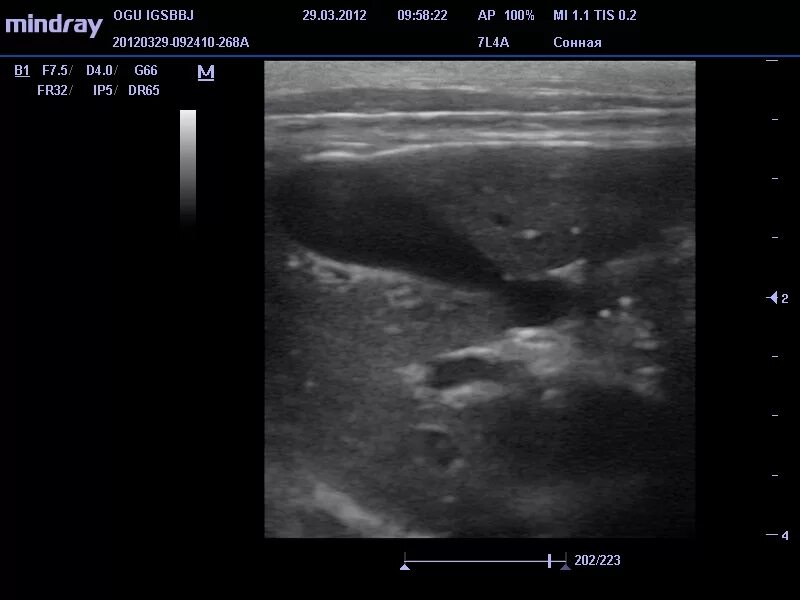 Узи печени собаки. Острый гепатит собак УЗИ.
