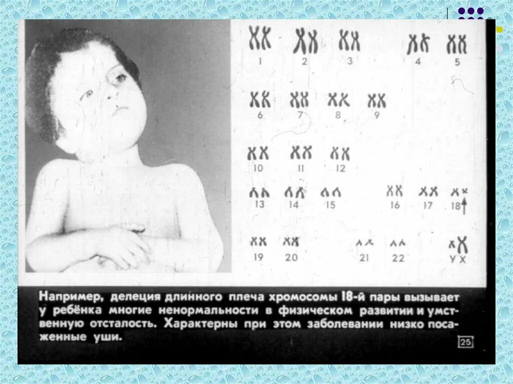 Различные формы хромосом по г. Типы метафазных хромосом рисунок. Строение хромосомы хроматиды. Короткое и длинное плечо хромосомы. Плечи хромосом это хроматиды.