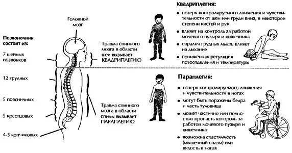 Почему так опасно повреждение спинного мозга. Осложнения позвоночно-спинномозговой травмы. осложнения ранений позвоночника и спинного мозга. осложнения при повреждении спинного мозга. повреждение спинного мозга в грудном отделе последствия.