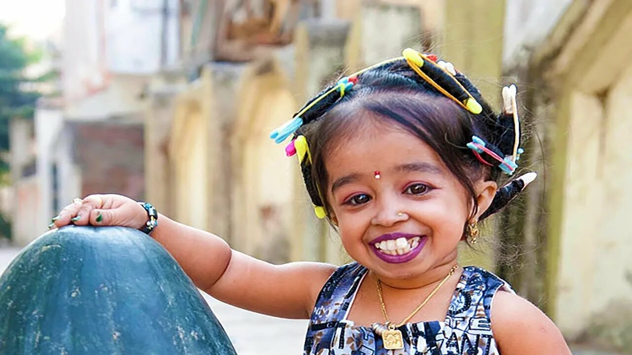 Сами удивительных людей. Джоти Амджи. Ранджана Амге. Необычные дети. Самые необычные дети на планете.