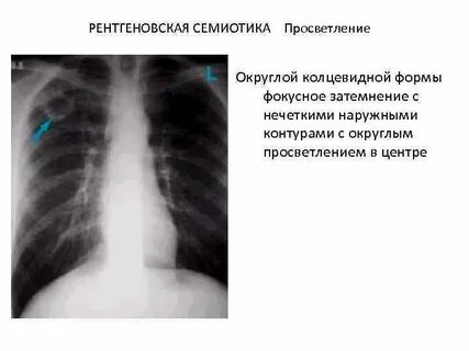 Затемнение неправильной формы