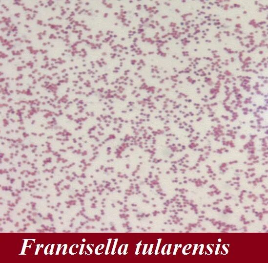 Туляремия Francisella tularensis. Francisella tularensis под микроскопом. Francisella tularensis морфология.