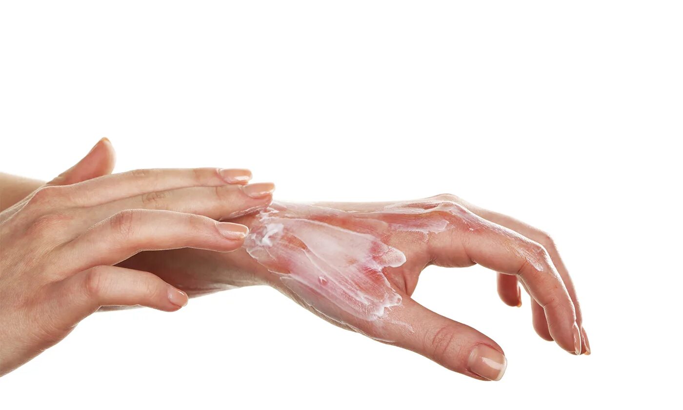 File:Silver nitrate stains.jpg - Wikipedia