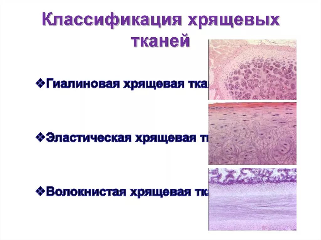 Суставный хрящ какая ткань. Строение гиалинового хряща гистология. Классификация хрящевых тканей гистология. Гиалиновый хрящ препарат гистология. Хрящевая гиалиновая соединительная ткань.