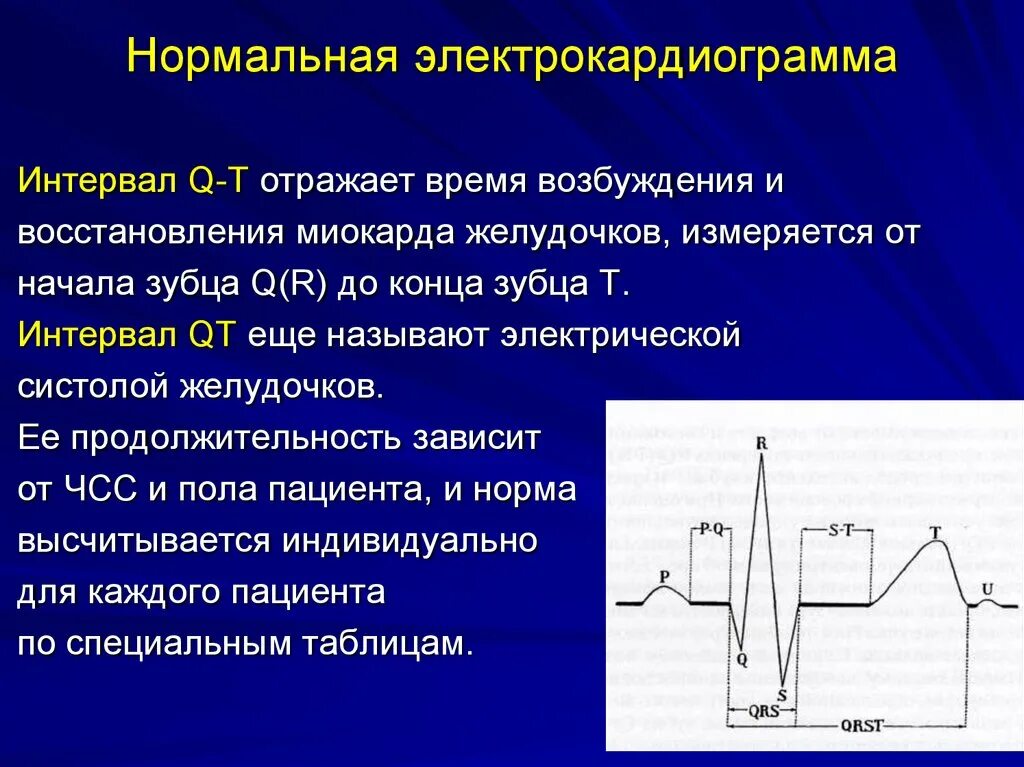 Электрокардиограмма отражает. Электрокардиограмма сердца отражает. Электрическую систолу желудочков на ЭКГ отражает. Электрокардиограмма отражает электрическую активность.