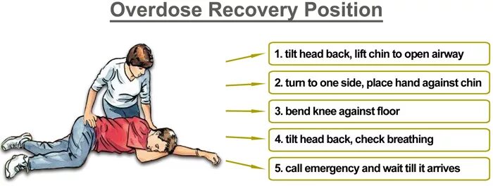 Recovery position. Положение «рекавери». Recovery position first Aid. Recovery position steps. First position