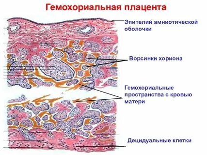 Ворсинки плаценты