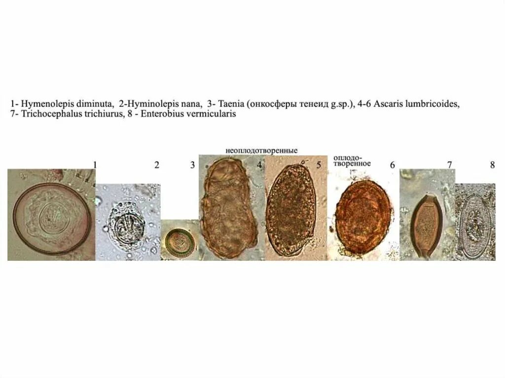 Яйца свиного цепня микроскоп. Яйца глистов бычий цепень. Яйца карликового цепня под микроскопом. Строение яйца цепня. Яйцо с онкосферой