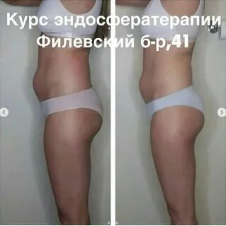 Эндосфера до и после фото