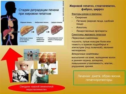 Жировая диета