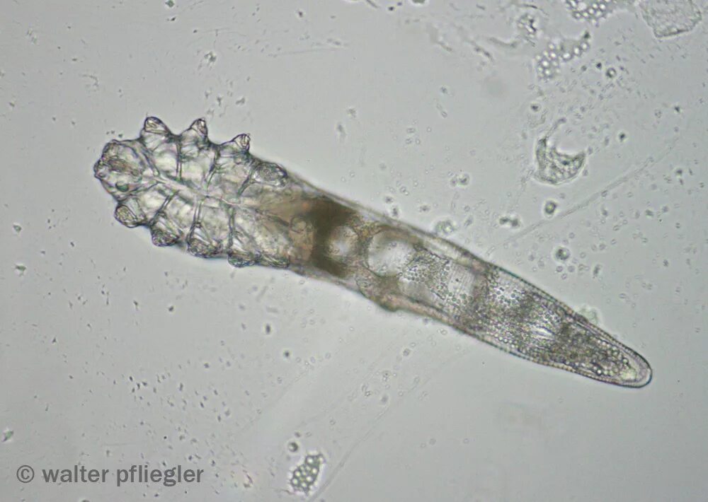 Demodex folliculorum заболевание