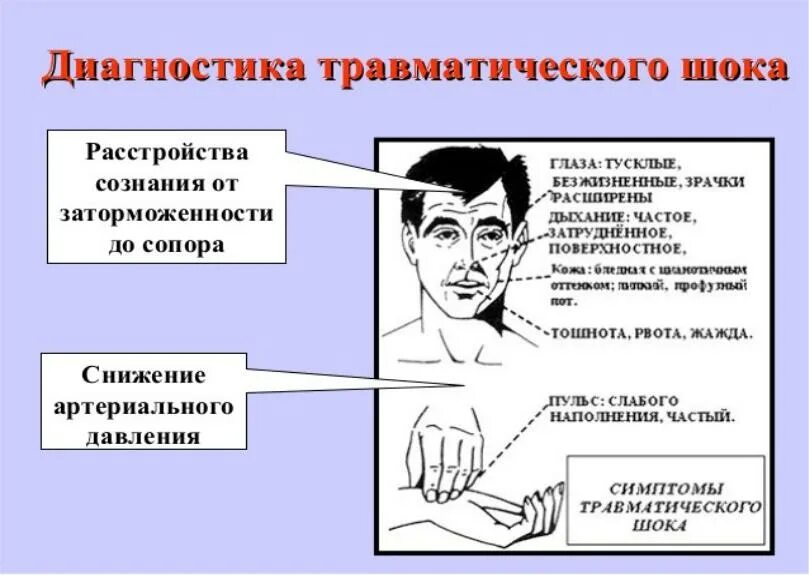 Эректильный шок. Диагностика травматического шока. Клиническая картина шока. Травматический ШОК диагноз. Диагностика шоковых состояний.