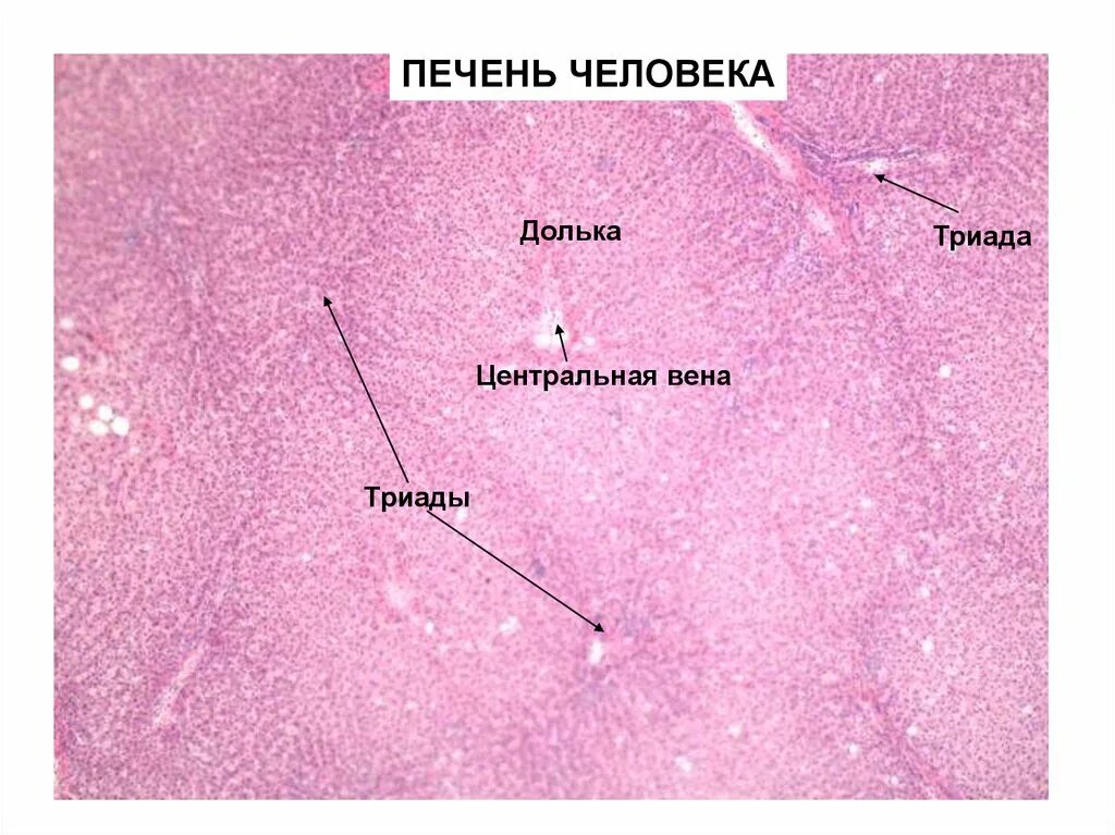 Триада печени. Триада печени гистология. Триада печени микропрепарат. Междольковая Триада печени.