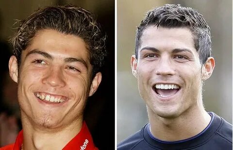 Криштиану Роналду Photo: Cristiano Ronaldo had a gaps between teeth 2.