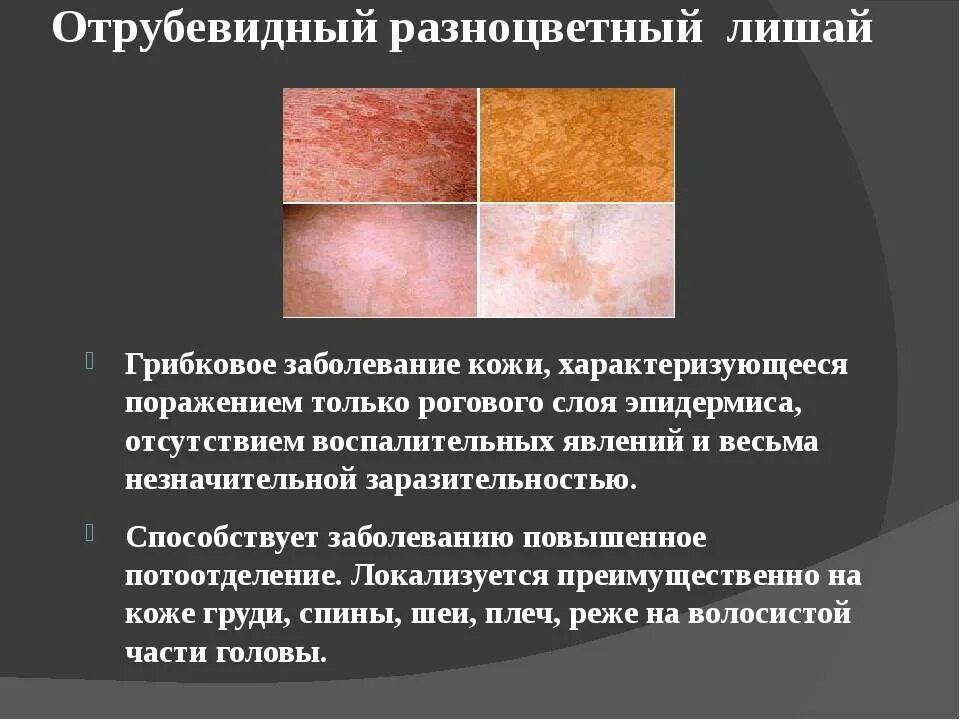 Заболевание кожи 8 класс кратко. Отрубевидный лишай. грибковое заболевание. цветной отрубевидный лишай. цветной отрубевидный лишай причина возникновения.