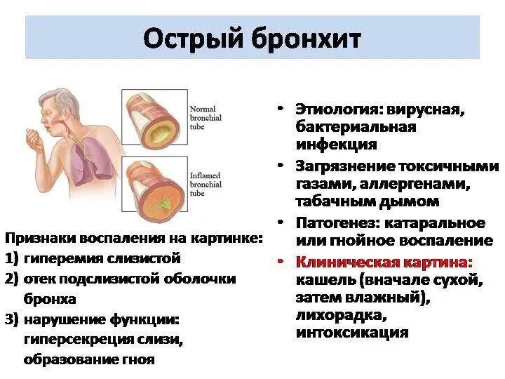 Кашель с мокротой 2 недели