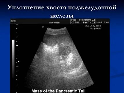 Уплотненные стенки